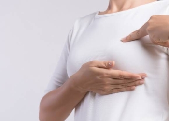 El cáncer de mama inflamatorio produce cambios en la piel en lugar de bultos, lo que dificulta su detección temprana. | Fuente: Mayo Clinic