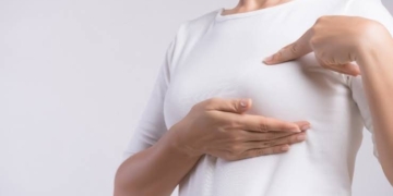 El cáncer de mama inflamatorio produce cambios en la piel en lugar de bultos, lo que dificulta su detección temprana. | Fuente: Mayo Clinic